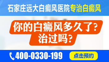 大面积的白癜风痊愈大概需要多久