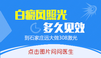 308激光治白癜风多久能看到黑色素长出来