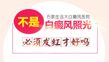 308激光照完白斑后红几天才是正常的