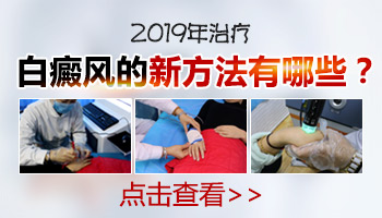 2019年治白癜风的是什么