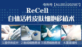 recell自体活性细胞再生术治白癜风怎么样