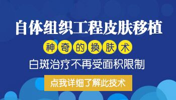 2019年有什么技术能治好白癜风了吗