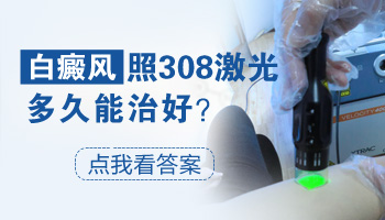 308激光照白癜风是按光斑收费还是次数