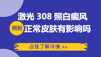 照白癜风的时候308照到正常皮肤有什么副作用吗