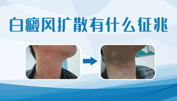耳朵后面有白斑会长到其他部位吗