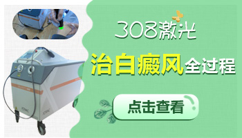 照308激光后白癜风皮肤刺痛是什么原因