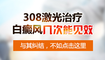 儿童胳膊上白癜风治疗需要多长时间见效