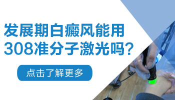 发展期白癜风照308合适吗 白斑怎么能控制住