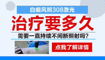 308窄谱紫外线照白癜风效果怎么样