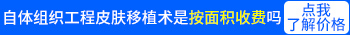 大面积白癜风表皮移植工程多少钱