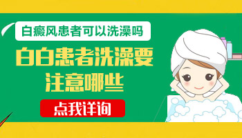 308光疗仪治疗手上的白癜风发红能洗澡吗