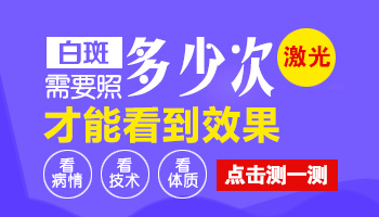 白癜风照多少次激光才能看到黑色素点