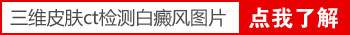 308激光治疗白癜风照射多少次才能做皮肤ct