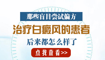 有什么偏方能够治疗白癜风吗