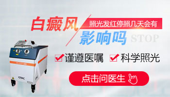308激光照完白癜风红几天好
