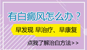 石家庄白癜风医院收费高不高