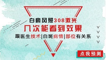 多长时间照一次308激光白斑好得快