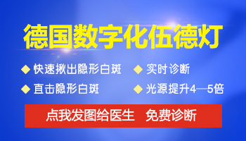 白癜风在伍德灯下发白但无荧光