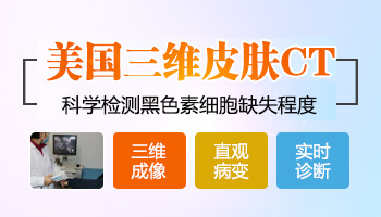 白癜风照308已经二十次了一点效果都没有