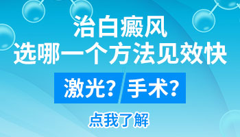 肢端型的白癜风照激光好还是种植好