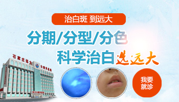 河北的医院哪家治疗白癜风比较好