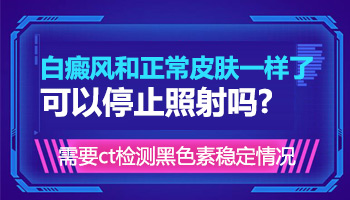 面部白癜风照激光能不能停一段时间