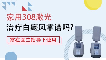 家庭版的308光疗仪能否治好白癜风