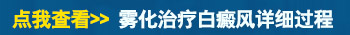 白癜风做308激光之前做雾化的作用是什么