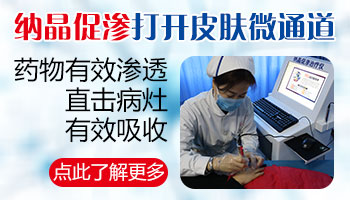 白癜风不治疗会发展到全身吗