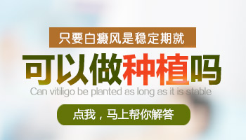 白癜风患者头皮可以植皮吗