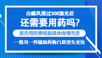 白癜风患者照射308后需要抹药膏吗