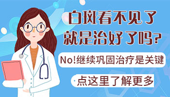 白斑复色还需要巩固多长时间
