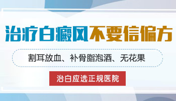 有没有控制白癜风扩散的偏方