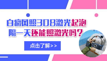 白癜风照光起泡了还能照光吗