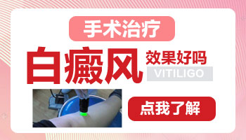 白癜风黑色素培植会不会后期发病或扩散