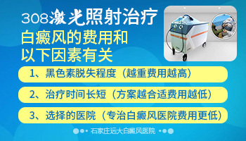 大面积白癜风照射308的费用是多少