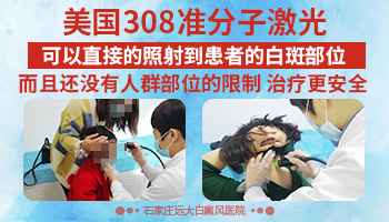 背部白斑发现一年多了怎么治疗 308治疗白斑效果怎么样