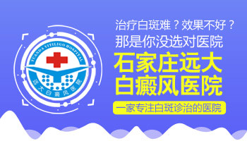 白癜风三年了一直用外用药治疗不见效果