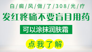 白癜风照了308光疗以后很红用擦药膏吗