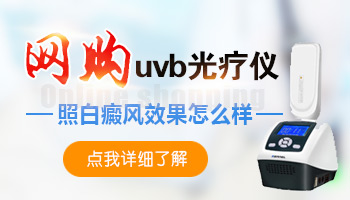 uvb光疗仪多少钱一台 治疗白癜风怎么样