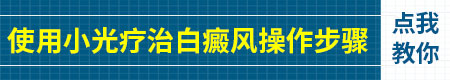 308准分子激光治疗白癜风可以在家做吗