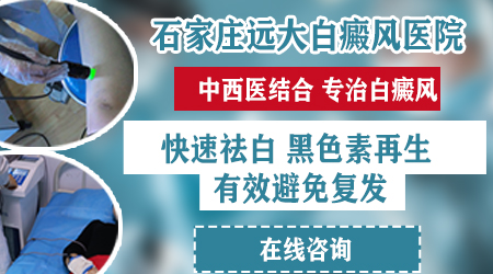 白癜风照308后停一个月又长白斑了怎么办