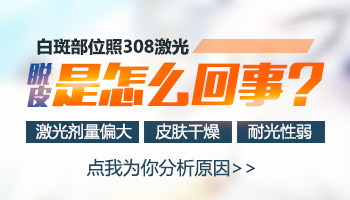 白癜风患者做完308激光脱皮怎么回事