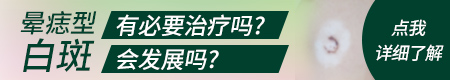 晕痣型白癜风是否可用激光祛痣