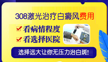 新一代308激光照白癜风多少钱