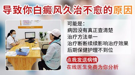 白癜风治疗过但没什么效果