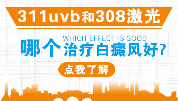 治疗白癜风用311uvb好还是308好