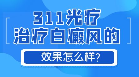 治疗白癜风有哪几种光疗仪 紫外线光疗仪效果怎么样