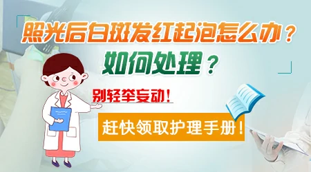 白癜风照完308激光起泡了怎么办