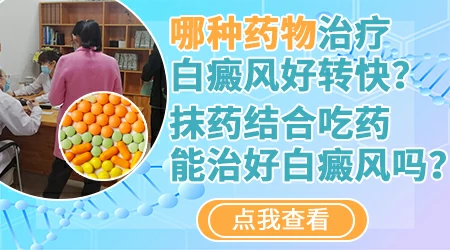 进展期白癜风能用卡力孜然酊吗